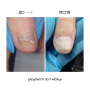 NAILSOFTHEDAY ONISTOP – регенеруюча олія проти оніхолізису, 8 мл