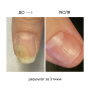 NAILSOFTHEDAY ONISTOP – регенеруюча олія проти оніхолізису, 8 мл