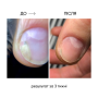 NAILSOFTHEDAY ONISTOP – регенеруюча олія проти оніхолізису, 8 мл