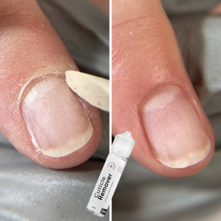 NAILSOFTHEDAY Cuticle Remover – регенеруючий кутикул ремувер для манікюру та педикюру, urea 10%, 60 мл
