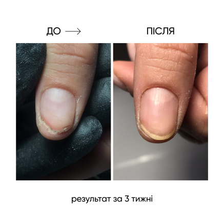 NAILSOFTHEDAY ONISTOP – регенеруюча олія проти оніхолізису, 8 мл