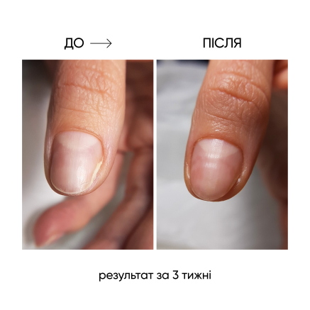 NAILSOFTHEDAY ONISTOP – регенеруюча олія проти оніхолізису, 8 мл