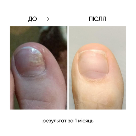 NAILSOFTHEDAY ONISTOP – регенеруюча олія проти оніхолізису, 8 мл