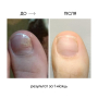 NAILSOFTHEDAY ONISTOP – регенеруюча олія проти оніхолізису, 8 мл