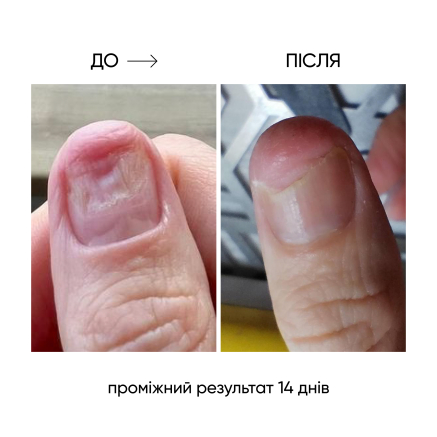 NAILSOFTHEDAY ONISTOP – регенеруюча олія проти оніхолізису, 8 мл