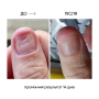 NAILSOFTHEDAY ONISTOP – регенеруюча олія проти оніхолізису, 8 мл