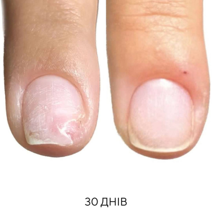 NAILSOFTHEDAY ONISTOP – регенеруюча олія проти оніхолізису, 8 мл