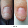 NAILSOFTHEDAY ONISTOP – регенеруюча олія проти оніхолізису, 8 мл
