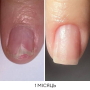 NAILSOFTHEDAY ONISTOP – регенеруюча олія проти оніхолізису, 8 мл