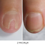 NAILSOFTHEDAY ONISTOP – регенеруюча олія проти оніхолізису, 15 мл