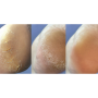 Nailsoftheday Podology+ КРЕМ від тріщин на шкірі рук та стоп, urea 12%, 30 мл